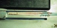 Hamstring tendon autograft for ACL reconstruction (image courtesy of orthoinfo.aaos.org)